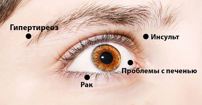 Ваши глаза могут рассказать о здоровье всего организма. 14 вещей!0