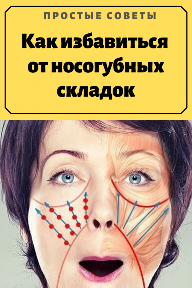 Как избавиться от носогубных складок