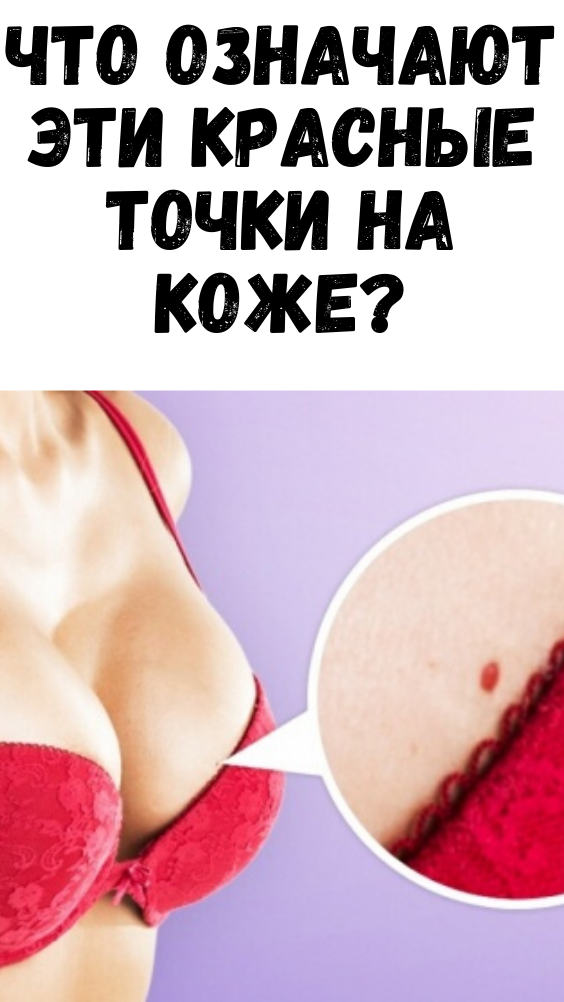 Что означают эти красные точки на коже?